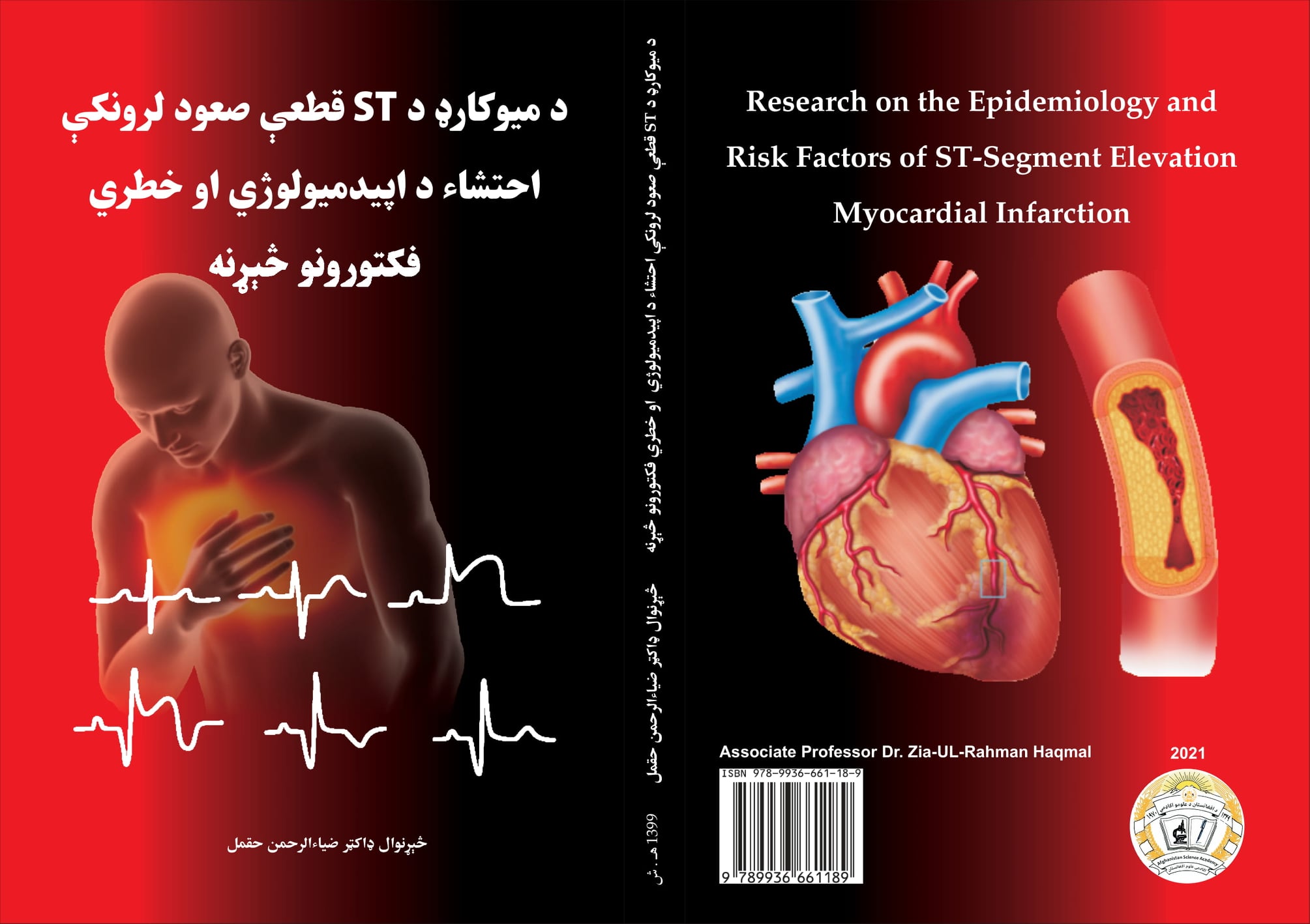 د میوکارډ د ST قطعې صعود لرونکې احتشاء د اپیدمیولوژي او خطري فکتورونو څېړنه